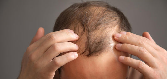 Salud Capilar Masculina - Caída del Cabello: Guía de Acción y Monitoreo